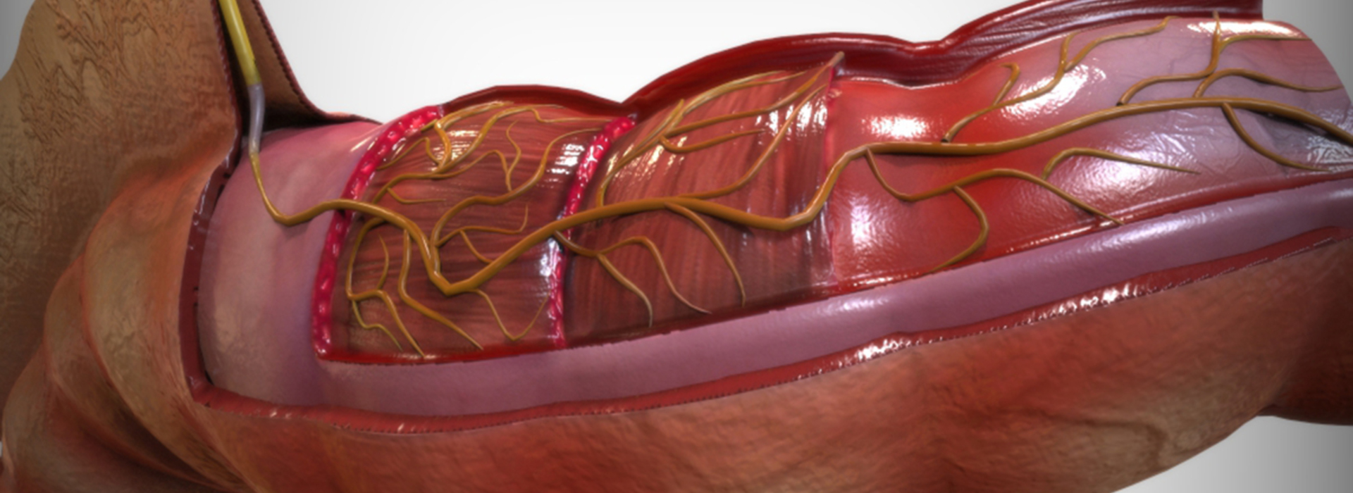 Product banner image